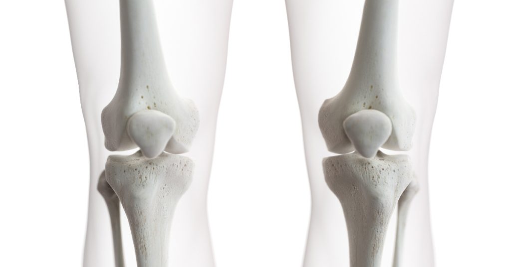 Anatomia ludzkiego stawu kolanowego z widokiem na struktury kostne, w tym rzepkę oraz kości udową i piszczelową, w białym kolorze na przezroczystym tle.